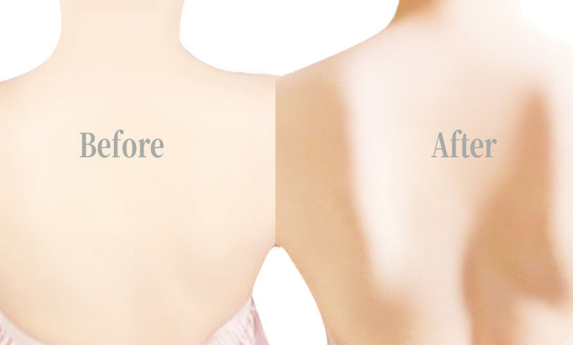 before-after画像